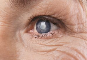 Estresse pode aumentar risco de glaucoma